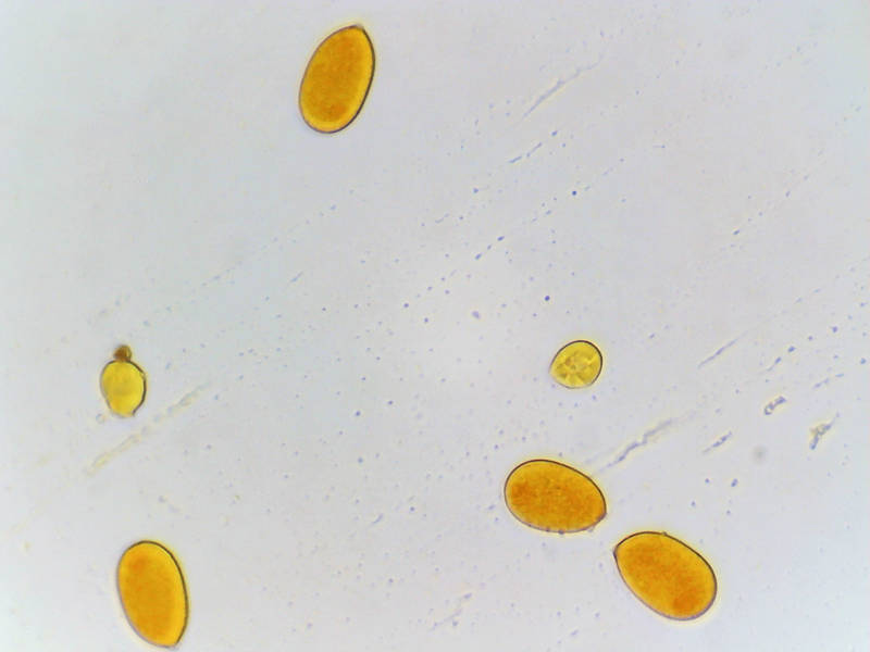 Spores of small pleurotoid mushrooms <B>Moniliophthora conchata</B> (Crinipellis conchata) or may be Marasmiellus "sp-TN01" from trampet vine (Foxglove vine, Campsis radicans) under a microscope with applied pressure, collected in South Wilderness of Sam Houston National Forest near Richards. Texas, May 8, 2022