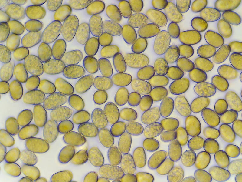 Spores of gunpowder amanita mushroom (<B>Amanita onusta</B>) under a microscope, collected in Lick Creek Park. College Station, Texas, May 13, 2022