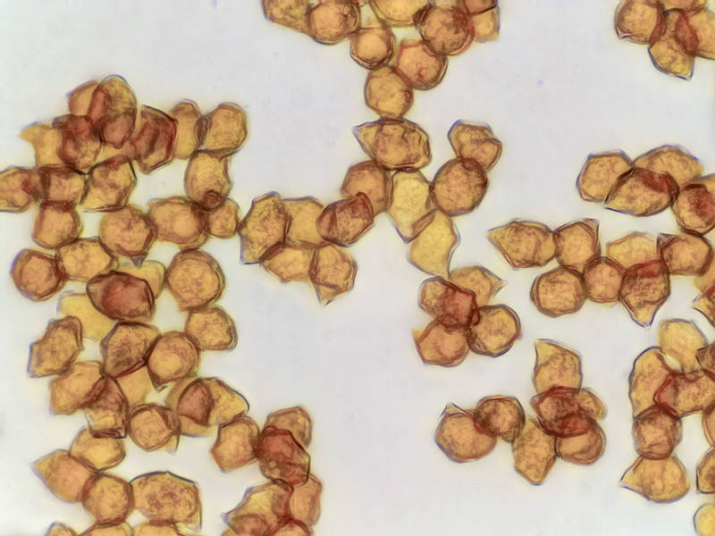 Spores of straight-stalked Entoloma mushrooms (<B>Entoloma strictius</B>) under a microscope, collected in Lick Creek Park. College Station, Texas, May 13, 2022