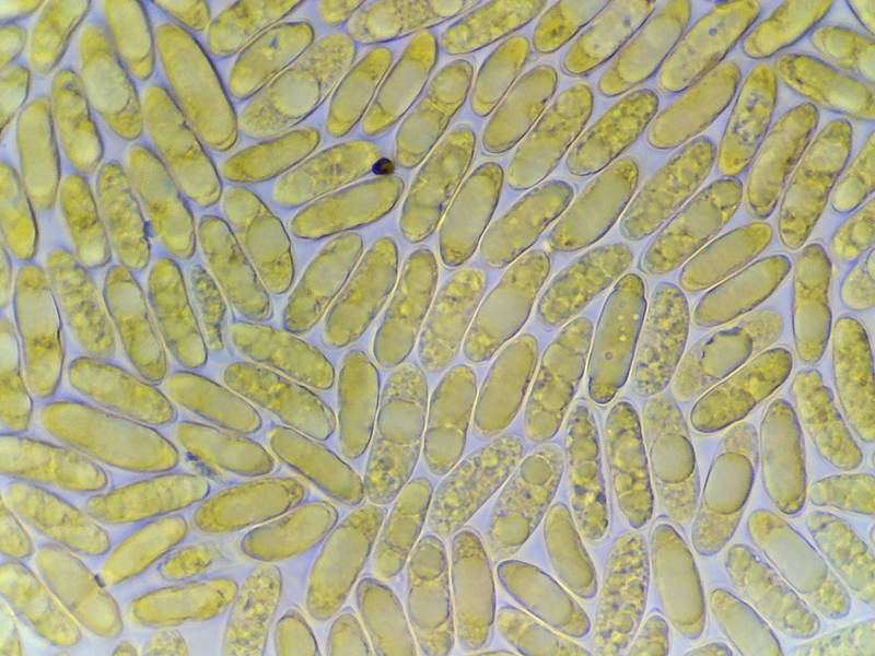 Spores of resupinate polypore mushroom <B>Megasporoporia setulosa</B> under a microscope, collected in Sam Houston National Forest a day before. Texas, May 29, 2022